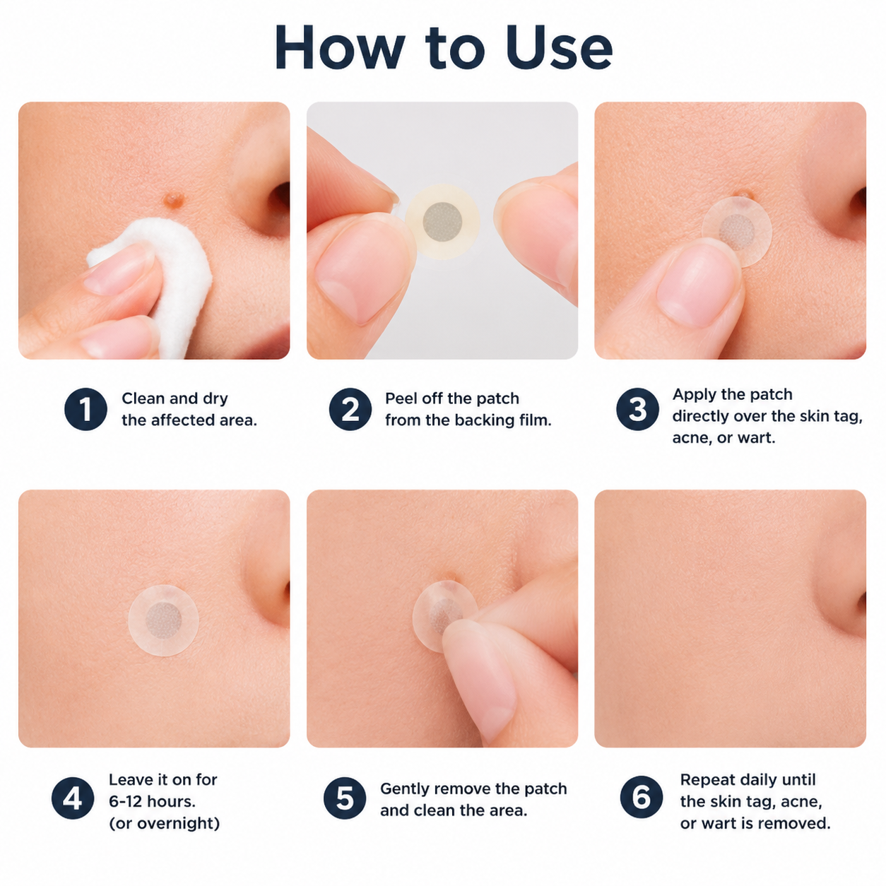 ✨2-in-1 Microneedle & Hydrocolloid Patch, Invisible Acne Patch for Face and Body, Helps Improve the Appearance of Wrinkles, Scars, Blemishes, and Skin Imperfections