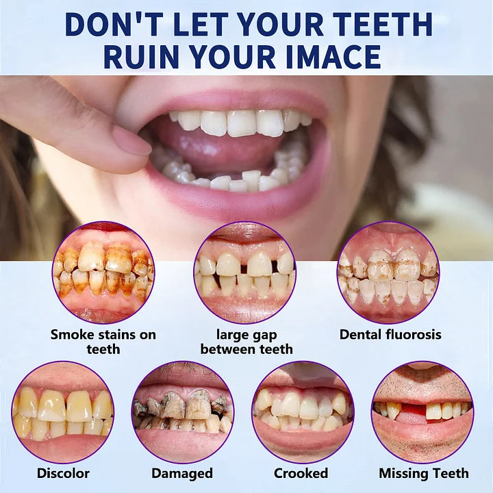 NESLEMYā¢-š¦·Advanced Customized Full Denture Set ā For a Perfect Smile and Natural Comfortš„°( š„Last Day Promotionš„ļ¼