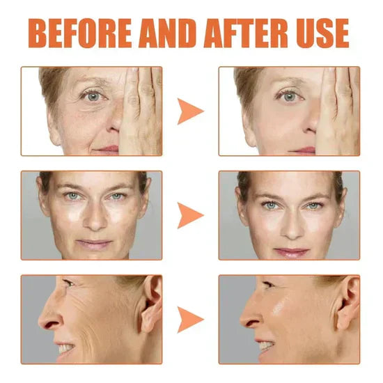 šLast Day Promotionš-Clostridium botulinum Face Serum