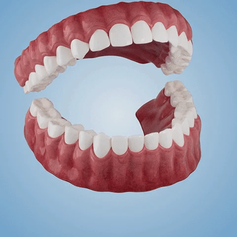 NESLEMYā¢-š¦·Advanced Customized Full Denture Set ā For a Perfect Smile and Natural Comfortš„°( š„Last Day Promotionš„ļ¼
