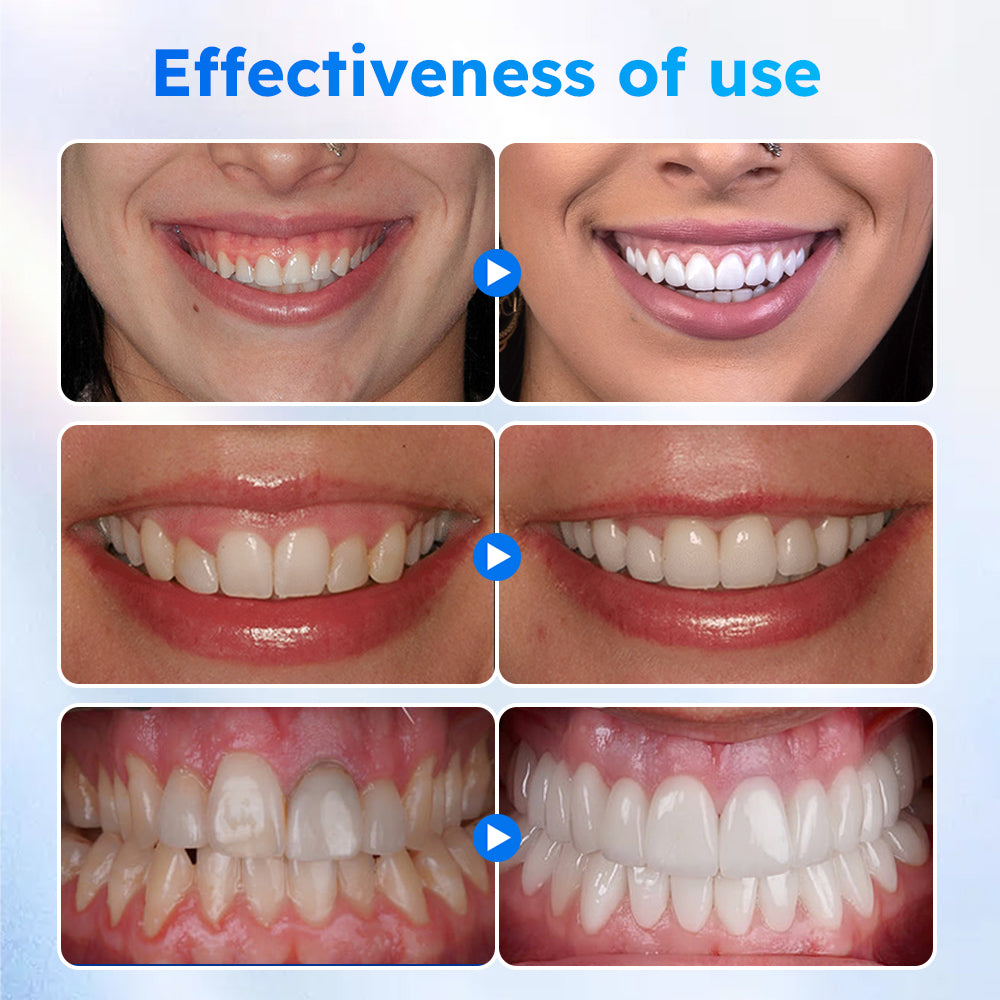 đĽ Limited time Discount - 80% off - LOVILDS⢠Oral Gel for Healthy gums and fresh Breath!