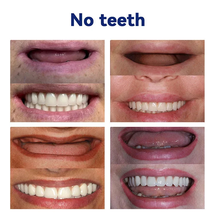 NESLEMYā¢-š¦·Advanced Customized Full Denture Set ā For a Perfect Smile and Natural Comfortš„°( š„Last Day Promotionš„ļ¼