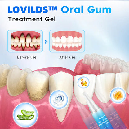 🔥 Limited time Discount - 80% off - LOVILDS™ Oral Gel for Healthy gums and fresh Breath!