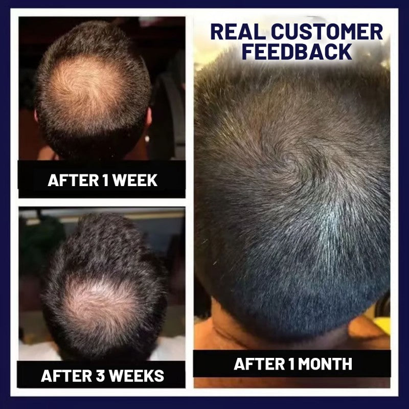 LOVILDS Natural Hair Regrowth Spray fb