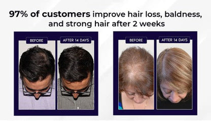 LOVILDS Natural Hair Regrowth Spray fb