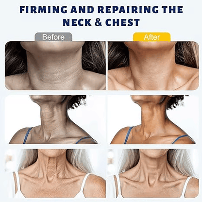 ✨ Wazendor™ Instant Neck Lift Cream  — 🧴 Infused with Retinol & Hyaluronic Acid | Firms the Neck, Reduces Wrinkles & Double Chin