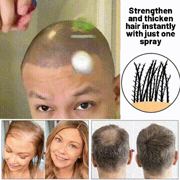 LOVILDS Natural Hair Regrowth Spray fb